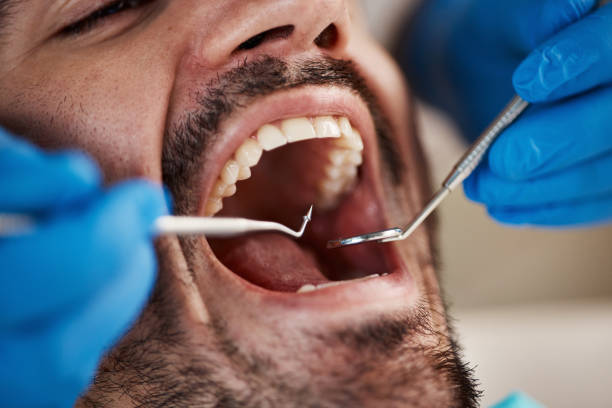 Emergency Dental Services in Byhalia, MS