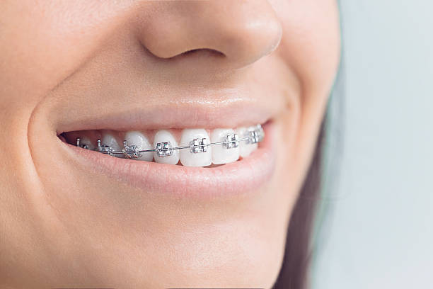 Best Traditional Braces  in Byhalia, MS